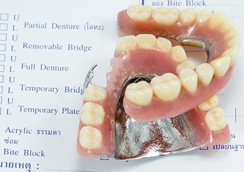 What did the first dentures look like?