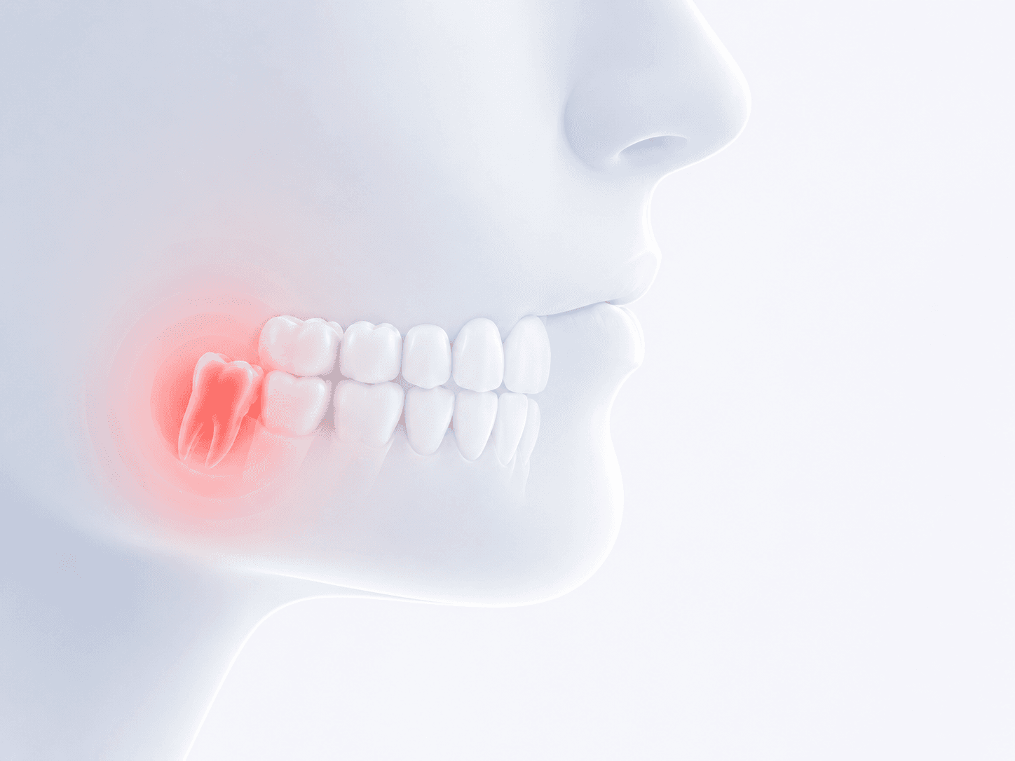Severe Toothache