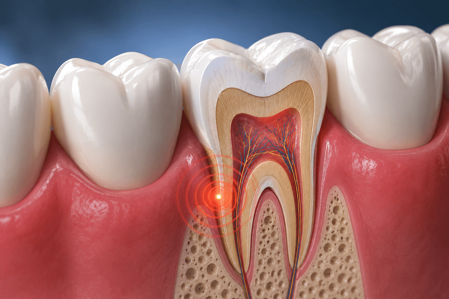 Tooth Sensitivity